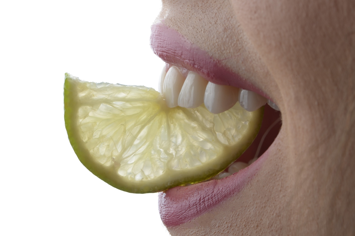 Zambet increzator, cu fatete dentare din ceramica sau fatete dentare din zirconiu la Clinica Dr Baldea din Timisoara. Smile makeover.