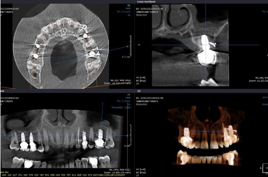computer tomograf la stomatolog. analize dentare complete