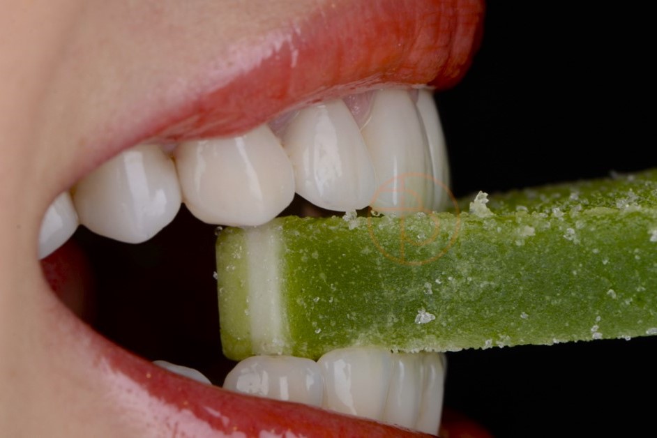 Dinti sanatosi si zambet frumos prin refacerea danturii. Coroane dentare ceramica si fatete dentare zirconiu, la clinica dentara Baldea Timisoara.