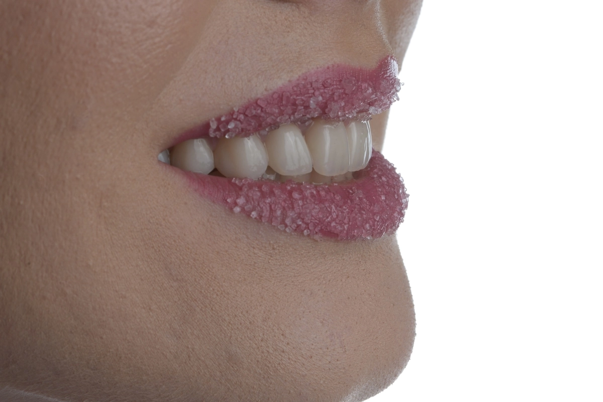 Transformarea zambetului cu fatete dentare in Timisoara prin Dr. Baldea Dental Clinic. Pret avantajos la pachet fatete dentare.
