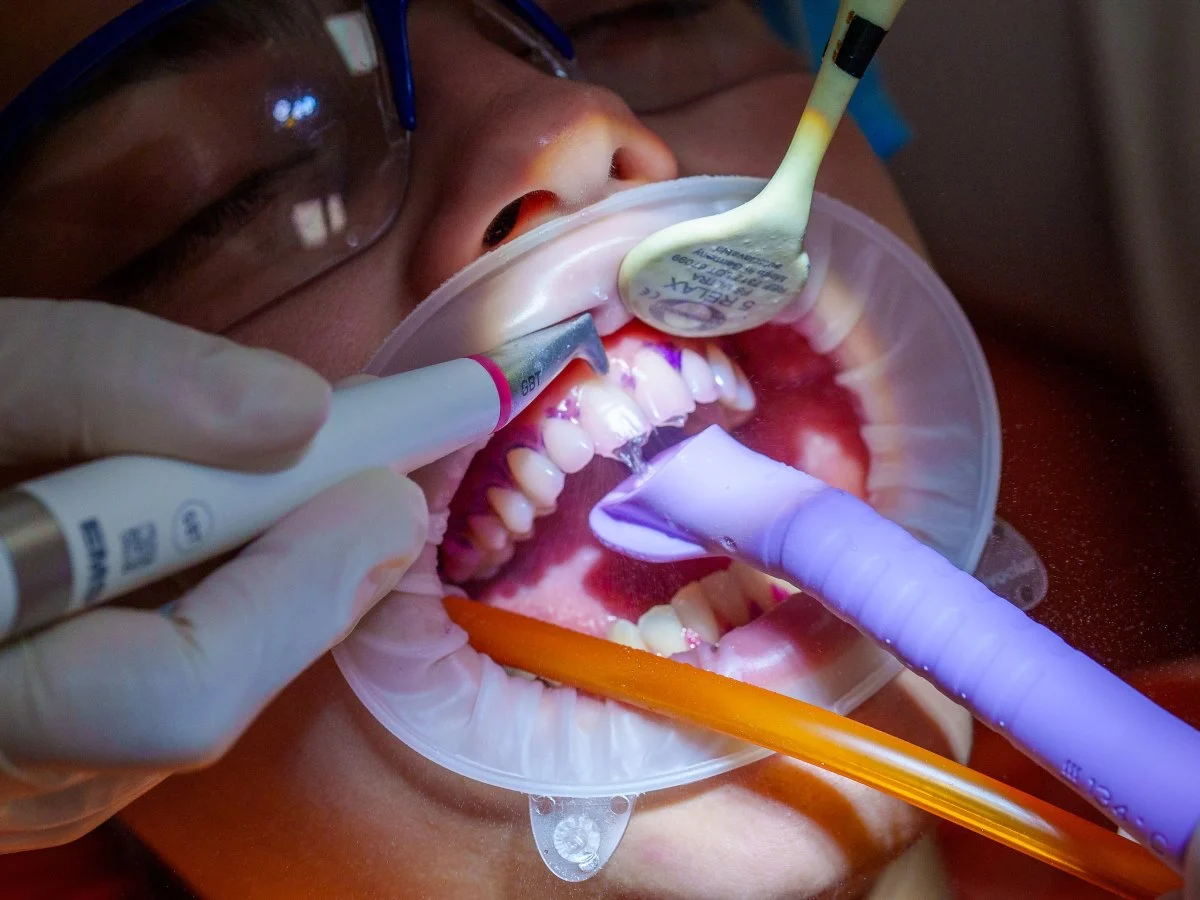 Igienizarea dentara profesionala cu tehnologia GBT la dr. Baldea Clinic Timisoara.