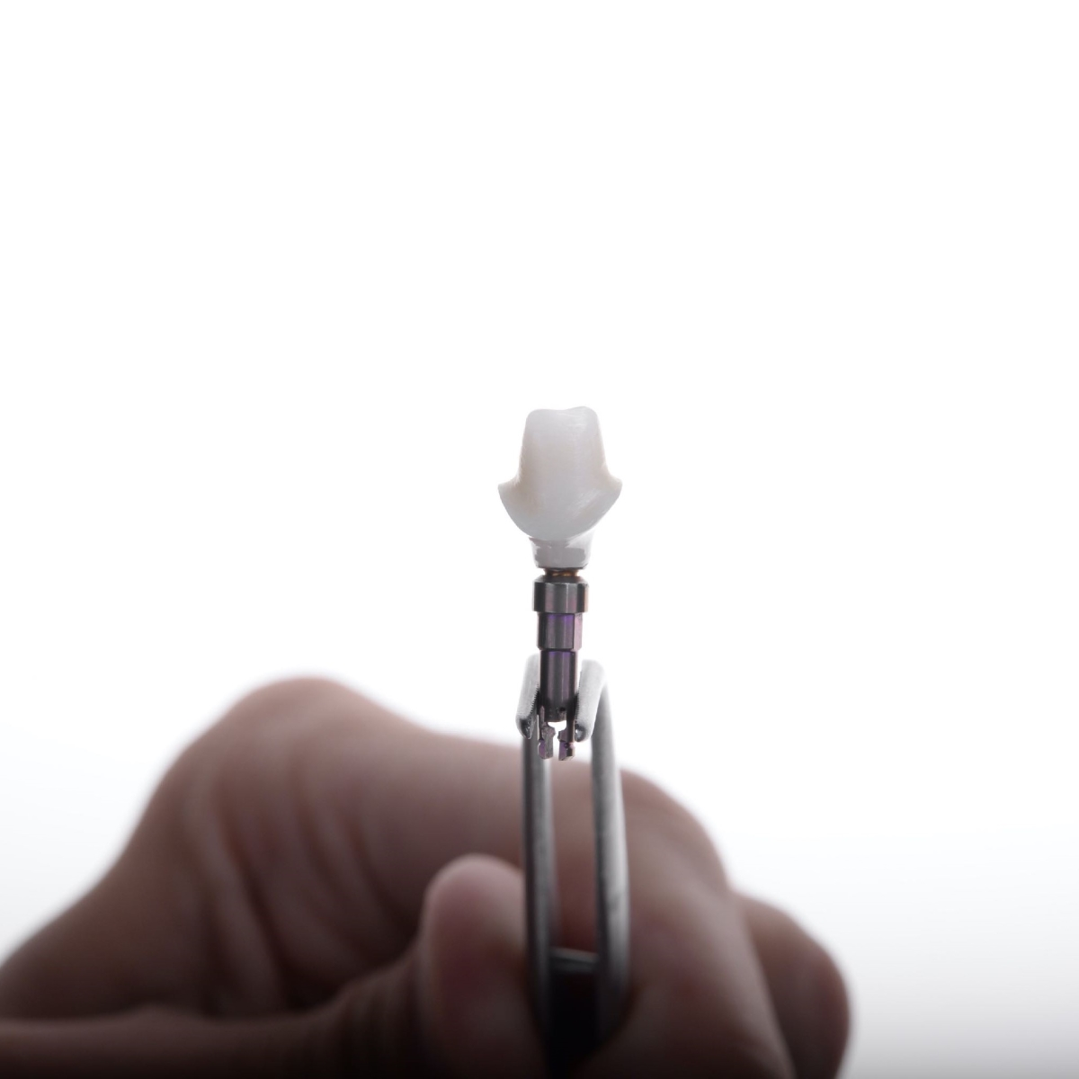 Stalp implant dentar la clinica de implantologie dentară avansata dr. Baldea din Timișoara.